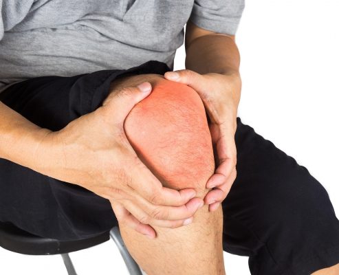 Cannabis bei chronischen Schmerzen: Eine Option für Schmerztherapie?